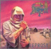 Leprosy